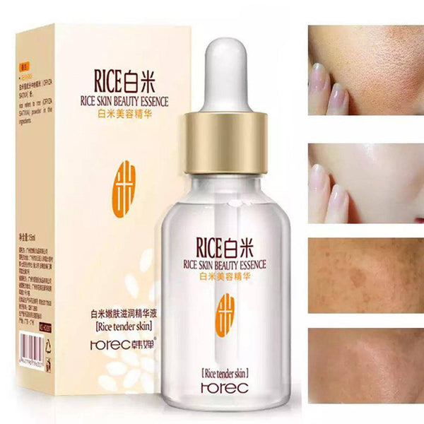 Rice skin beauty essence bottle and packaging with before and after skin comparison on a white background